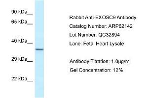 Western Blotting (WB) image for anti-Exosome Component 9 (EXOSC9) (N-Term) antibody (ABIN970651) (EXOSC9 antibody  (N-Term))
