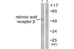 Western Blotting (WB) image for anti-Retinoic Acid Receptor, beta (RARB) (C-Term) antibody (ABIN1848760) (Retinoic Acid Receptor beta antibody  (C-Term))