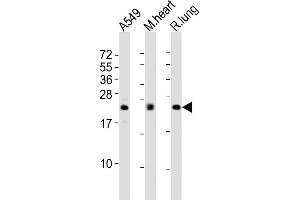 All lanes : Anti-FGF2 Antibody at 1:2000 dilution Lane 1: A549 whole cell lysates Lane 2: mouse heart lysates Lane 3: rat lung lysates Lysates/proteins at 20 μg per lane. (FGF2 antibody)