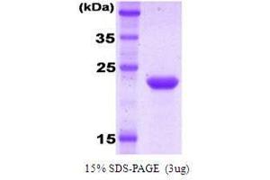 Figure annotation denotes ug of protein loaded and % gel used. (KIR2DL1 Protein)