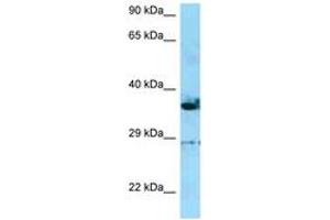 Image no. 1 for anti-Inverted Formin, FH2 and WH2 Domain Containing (INF2) (C-Term) antibody (ABIN6748410) (INF2 antibody  (C-Term))