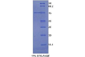 SDS-PAGE analysis of Human Integrin alpha M (ITGAM) Protein. (CD11b Protein)