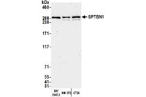 Western Blotting (WB) image for anti-Spectrin Beta, Non-Erythrocytic 1 (SPTBN1) (AA 2100-2150) antibody (ABIN7454694)