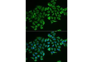 Immunofluorescence analysis of MCF-7 cells using RHOD antibody (ABIN6131344, ABIN6146938, ABIN6146939 and ABIN6222119). (RHOD antibody  (AA 1-210))