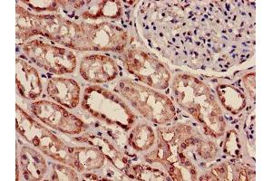 Immunohistochemistry of paraffin-embedded human kidney tissue using ABIN7160596 at dilution of 1:100 (Myosin 9 antibody  (AA 2-241))