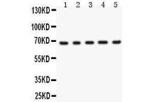 Anti- Menin Picoband antibody, Western blotting All lanes: Anti Menin  at 0. (Menin antibody  (AA 301-615))