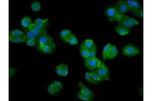 Immunofluorescence staining of HepG2 cells with ABIN7169218 at 1:200, counter-stained with DAPI. (VRK2 antibody  (AA 317-472))