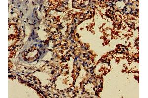 IHC image of ABIN7152978 diluted at 1:800 and staining in paraffin-embedded human lung tissue performed on a Leica BondTM system. (FLT3LG antibody  (AA 27-184))