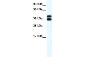 RFP2 antibody used at 2. (TRIM13 antibody  (Middle Region))