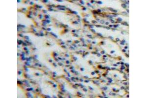 Used in DAB staining on fromalin fixed paraffin-embedded Spleen tissue (SIGLEC5 antibody  (AA 18-135))