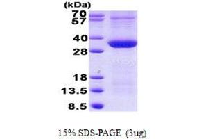 Image no. 1 for Pim-1 Oncogene (PIM1) protein (His tag) (ABIN7280180) (PIM1 Protein (His tag))