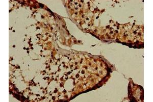 Immunohistochemistry of paraffin-embedded human testis tissue using ABIN7161815 at dilution of 1:100 (NUP107 antibody  (AA 1-66))