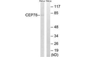 Western blot analysis of extracts from HeLa cells, using CEP78 Antibody. (CEP78 antibody  (AA 301-350))