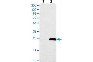 Western blot analysis of Lane 1: Negative control (vector only transfected HEK293T lysate), Lane 2: Over-expression Lysate (Co-expressed with a C-terminal myc-DDK tag (~3. (TMEM204 antibody)