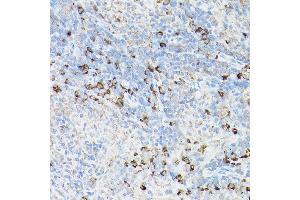 Immunohistochemistry of paraffin-embedded rat spleen using Fas Rabbit pAb (ABIN1683066, ABIN1683065, ABIN5664115 and ABIN6219731) at dilution of 1:100 (40x lens). (FAS antibody  (AA 61-335))