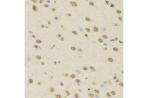 Immunohistochemistry (Paraffin-embedded Sections) (IHC (p)) image for anti-Heterogeneous Nuclear Ribonucleoprotein D (HNRNPD) (AA 1-306) antibody (ABIN6141905)
