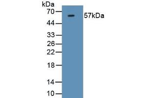 Detection of Recombinant FOXP3, Mouse using Monoclonal Antibody to Forkhead Box P3 (FOXP3) (FOXP3 antibody  (AA 190-412))