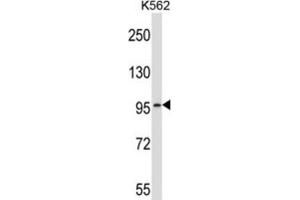 Western Blotting (WB) image for anti-phosphodiesterase 6A, CGMP-Specific, Rod, alpha (PDE6A) antibody (ABIN2997217) (PDE6A antibody)