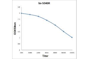 Antigen: 2 µg/100 µL  Primary: Antiserum, 1:500, 1:1000, 1:2000, 1:4000, 1:8000, 1:16000, 1:32000;  Secondary: HRP conjugated Rabbit Anti-Goat IgG at 1: 5000;  TMB staining Read the data in Microplate Reader by 450nm. (BAAT antibody  (AA 101-200))