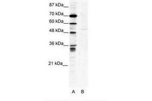Image no. 1 for anti-Zinc Finger Protein 134 (ZNF134) (AA 93-142) antibody (ABIN202498) (ZNF134 antibody  (AA 93-142))