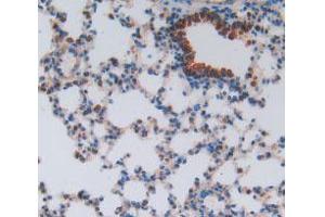 IHC-P analysis of Mouse Lung Tissue, with DAB staining. (HEXB antibody  (AA 101-217))