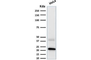 Formalin-fixed, paraffin-embedded human Pancreas stained with Ferritin, Light Chain Mouse Monoclonal Antibody (FTL/1389). (FTL antibody  (AA 38-165))