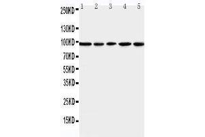 Anti-MCM6 antibody, Western blotting Lane 1: U87 Cell Lysate Lane 2: COLO320 Cell Lysate Lane 3: HELA Cell Lysate Lane 4: MCF-7 Cell Lysate Lane 5: JURKAT Cell Lysate (MCM6 antibody  (Middle Region))