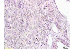 Immunohistochemistry (IHC) image for anti-alpha-Fetoprotein (AFP) antibody (ABIN722901) (alpha Fetoprotein antibody)