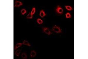 Immunofluorescent analysis of CDK6 staining in K562 cells. (CDK6 antibody)