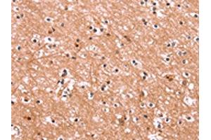 The image on the left is immunohistochemistry of paraffin-embedded Human brain tissue using ABIN7190562(ENPP4 Antibody) at dilution 1/15, on the right is treated with synthetic peptide. (ENPP4 antibody)