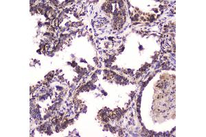 IHC analysis of BRD7 using anti-BRD7 antibody . (BRD7 antibody  (AA 514-567))