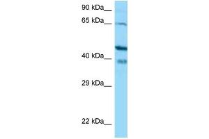 Western Blotting (WB) image for anti-Calcium Binding Protein 1 (CABP1) (N-Term) antibody (ABIN2774384) (CABP1 antibody  (N-Term))
