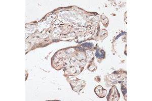 Immunohistochemistry of paraffin-embedded human placenta using SPDEF antibody (ABIN6132572, ABIN6148332, ABIN6148334 and ABIN6218364) at dilution of 1:100 (40x lens). (SPDEF/PSE antibody  (AA 1-335))