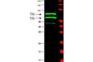 Western blot using CCNT2 polyclonal antibody  is shown to detect two major bands (arrowheads) corresponding to human CCN T2a and T2b as indicated.