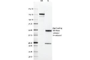 SDS-PAGE Analysis Purified CD2 Mouse Monoclonal Antibody (RPA-2. (CD2 antibody)