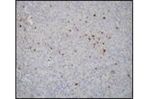 Immunohistochemistry (IHC) image for anti-PDZ and LIM Domain 7 (Enigma) (PDLIM7) (C-Term) antibody (ABIN870474) (PDLIM7 antibody  (C-Term))