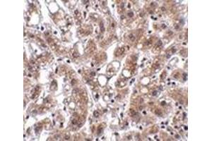 Immunohistochemistry of THEM4 in human liver tissue with this product at 2. (THEM4 antibody  (Center))
