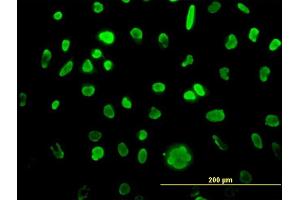Immunofluorescence of monoclonal antibody to MCM3 on HeLa cell. (MCM3 antibody  (AA 699-808))