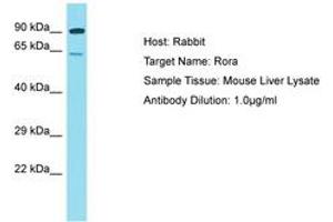 Image no. 1 for anti-RAR-Related Orphan Receptor A (RORA) (AA 201-250) antibody (ABIN6750242) (RORA antibody  (AA 201-250))