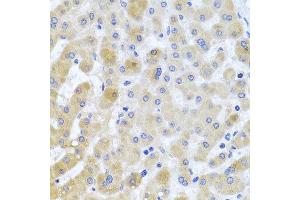 Immunohistochemistry of paraffin-embedded human liver injury using EIF3M antibody at dilution of 1:100 (x40 lens).
