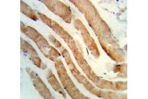 IHC analysis of FFPE human skeletal muscle stained with RAB7 antibody (RAB7A antibody  (AA 176-204))