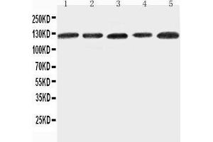 Anti-ITGA7 antibody, Western blotting Lane 1: 293T Cell Lysate Lane 2: A431 Cell Lysate Lane 3: HELA Cell Lysate Lane 4: JURKAT Cell Lysate Lane 5: RAJI Cell Lysate (ITGA7 antibody  (C-Term))