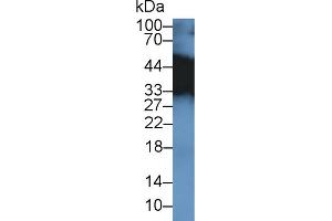 Western Blot; Sample: Mouse Placenta lysate; Primary Ab: 2µg/ml Rabbit Anti-Mouse TPM3 Antibody Second Ab: 0.