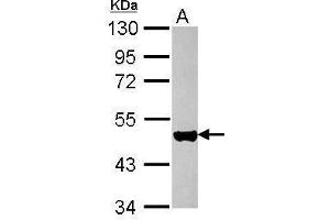WB Image Sample (30 ug of whole cell lysate) A: HeLa 10% SDS PAGE antibody diluted at 1:10000 (KRT17 antibody)