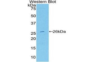 Western Blotting (WB) image for anti-Deoxyribonuclease I-Like 2 (DNASE1L2) (AA 32-229) antibody (ABIN1858656) (DNASE1L2 antibody  (AA 32-229))
