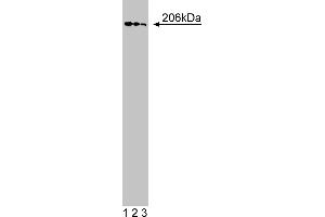 Western Blotting (WB) image for anti-Golgi Brefeldin A Resistant Guanine Nucleotide Exchange Factor 1 (GBF1) (AA 1266-1379) antibody (ABIN968745) (GBF1 antibody  (AA 1266-1379))