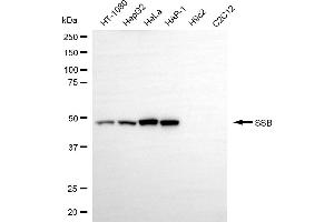 Western blotting analysis using SSB antibody (ABIN7800358).