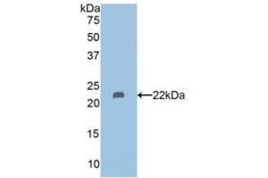 Detection of Recombinant HDAC6, Human using Polyclonal Antibody to Histone Deacetylase 6 (HDAC6) (HDAC6 antibody  (AA 166-348))