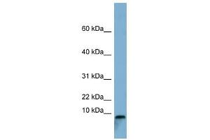 TCTA antibody used at 1 ug/ml to detect target protein. (TCTA antibody  (Middle Region))