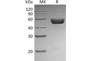 Western Blotting (WB) image for Renin (REN) protein (His tag) (ABIN7320778) (Renin Protein (REN) (His tag))